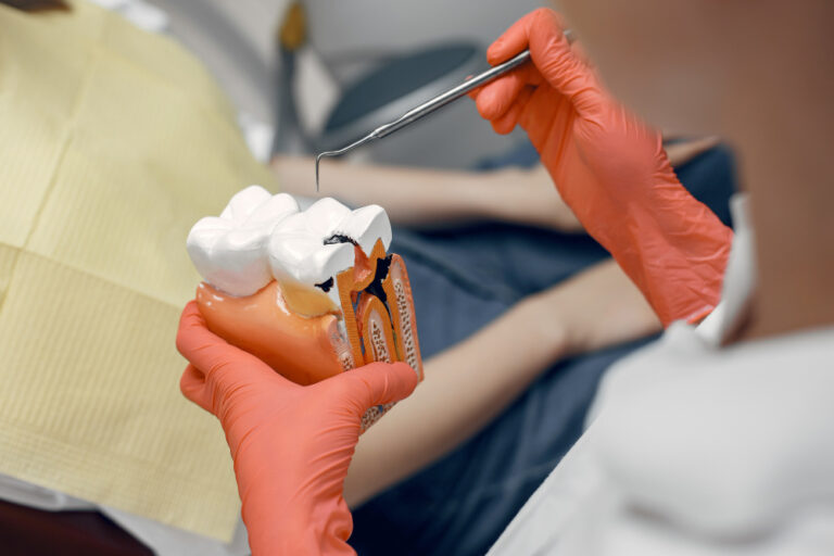 Root Canal vs Tooth Extraction | Chic Clinic