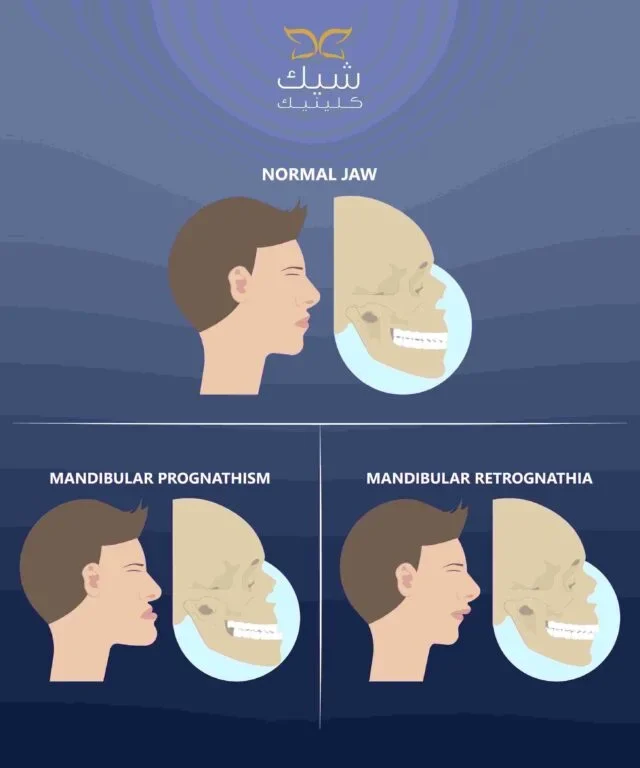 لماذا تعتبر شيك كلينيك الوجهة الأولى لـ تقويم الأسنان التجميلي؟